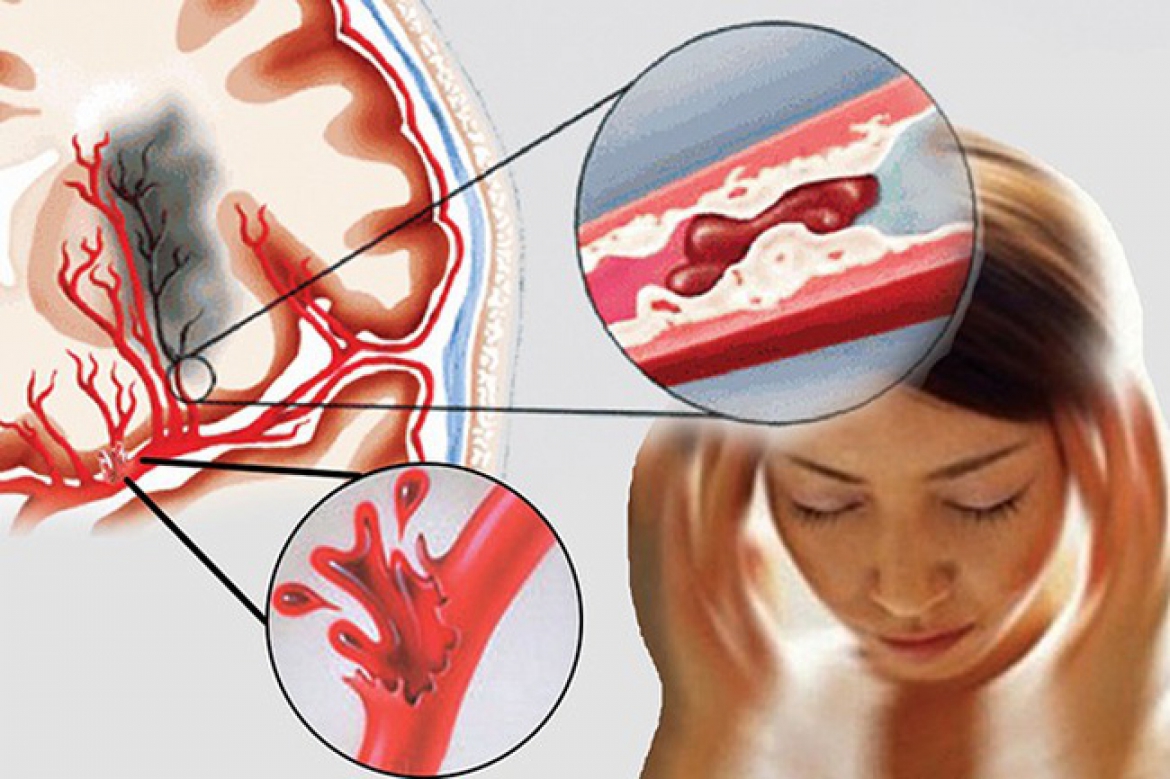 Những dấu hiệu nhận biết khi cơ thể thiếu vitamin