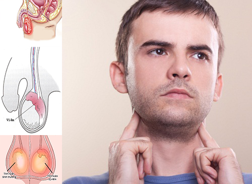 Nhận biết và xử lý bệnh viêm quai bị