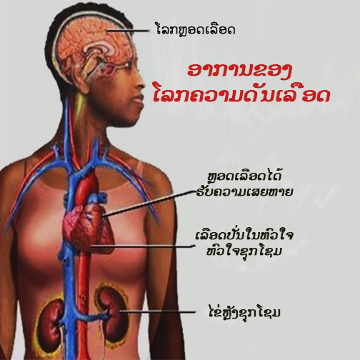 ຜົນຮ້າຍແລະການປ້ອງກັນພະຍາດຄວາມດັນເລືອດ