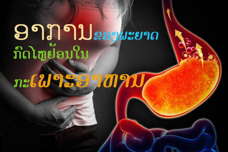 ອາການຂອງພະຍາດກົດໄຫຼຢ້ອນໃນກະເພາະອາຫານ