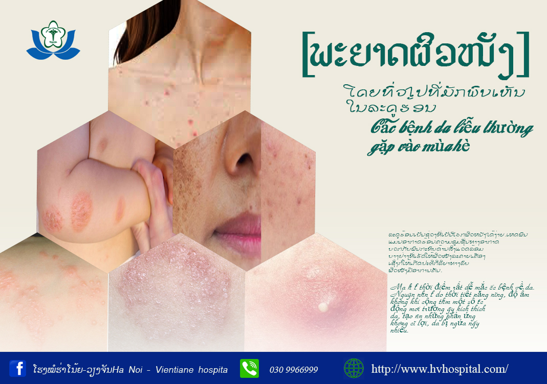 Các bệnh da liệu hay gặp trong mùa hè