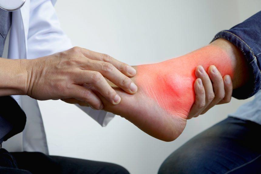 What are eating suggestions for people have gout. 
